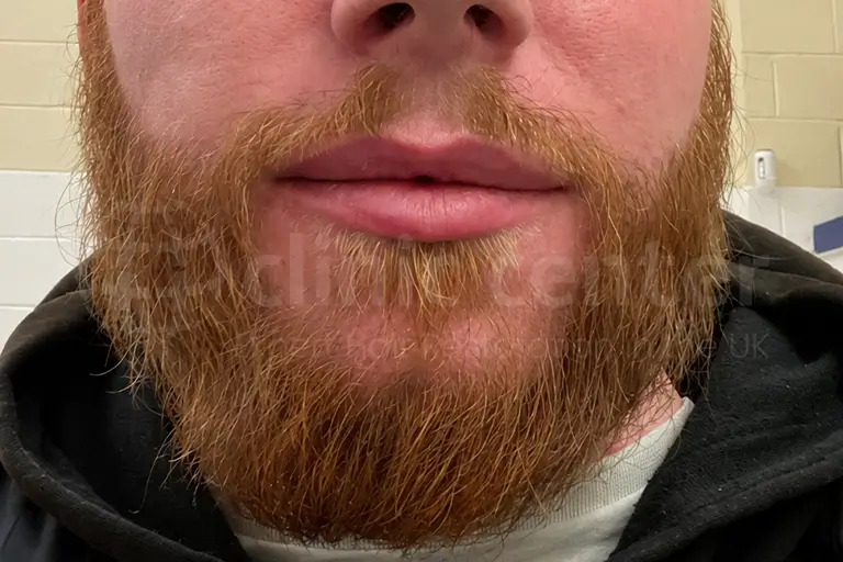 After