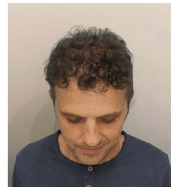 resized_before-after-clinic-center-london-2 resized_before-after-clinic-center-london-2