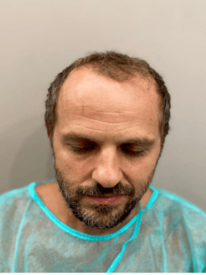 resized_before-after-clinic-centre-london resized_before-after-clinic-centre-london